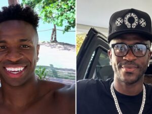 El impactante cambio estético de Vinicius Jr tras el Mundial con Brasil: nuevo rostro y “armonización de mentón”